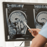 Colorado Brain Injury Motorcycle Accident Attorneys