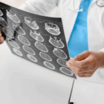 Denver Traumatic Brain Injury Attorneys