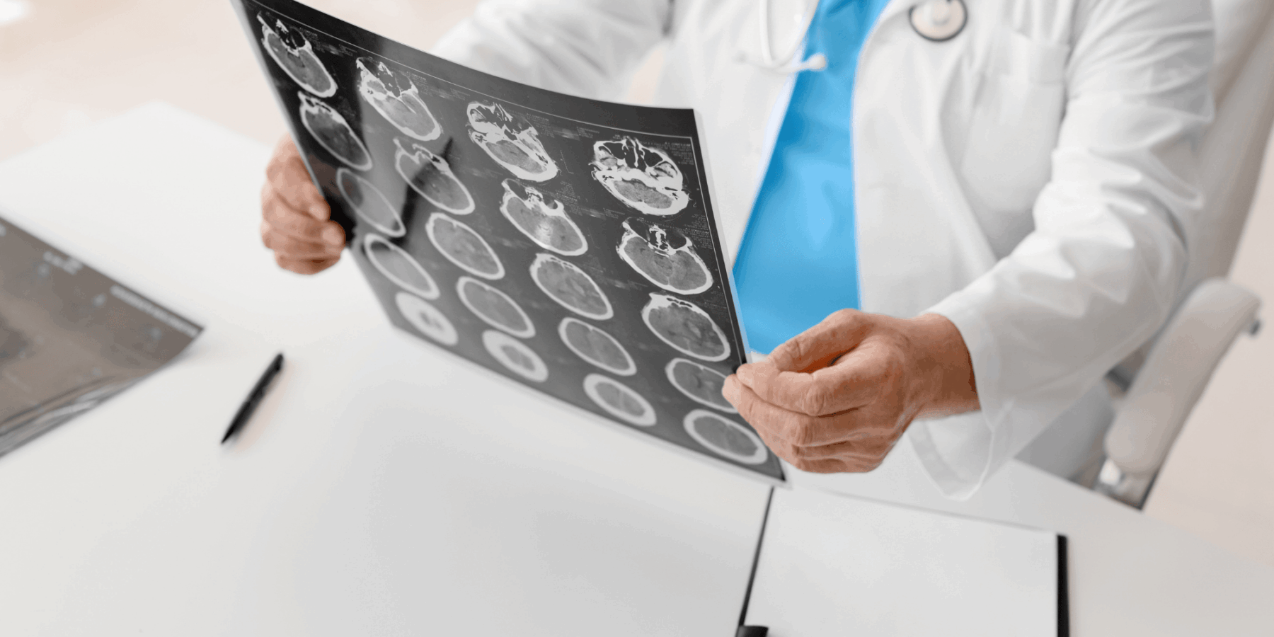 Denver Traumatic Brain Injury Attorneys