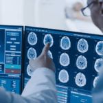 Traumatic Brain Injury Attorneys in Castle Rock