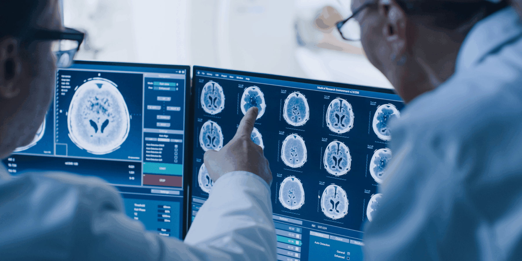 Traumatic Brain Injury Attorneys in Castle Rock