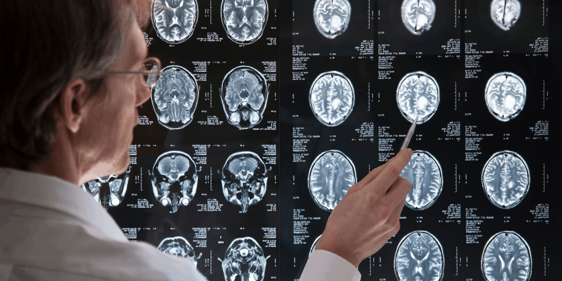 Traumatic Brain Injury Attorneys in Lakewood