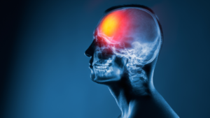 How a Traumatic Brain Injury Attorney Can Help Injured Pedestrian Victims in Adams County